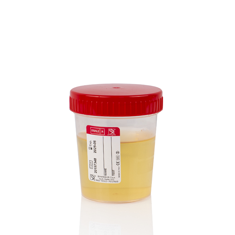 4 Contenitori per urina con tappo ermetico a vite 120 ml - analisi urine